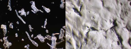 Vlevo Nasaleze prášek v suchém stavu (100 x zvětšeno), vpravo Nasaleze ochranná vrstva na nosní sliznici (100 x zvětšeno)